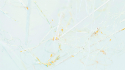 井上裕葵 個展　|　アクセスワール